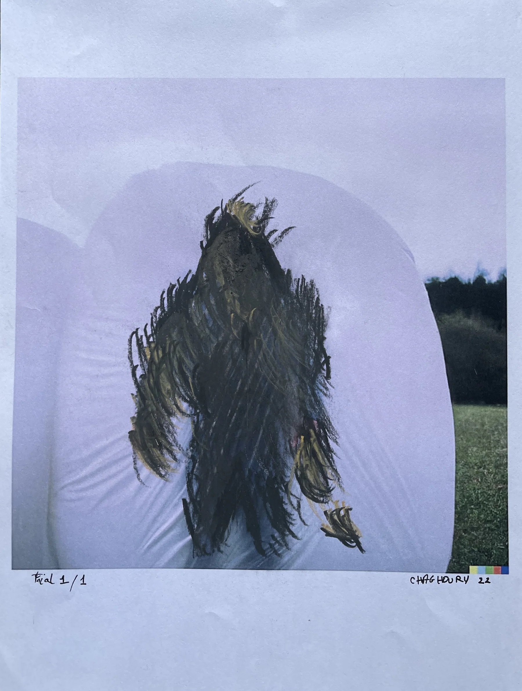 Trauma